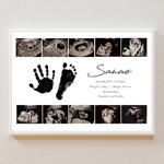 送料無料𓅯 ⸒⸒エコーポスター　エコー写真ポスター　エコーアルバム