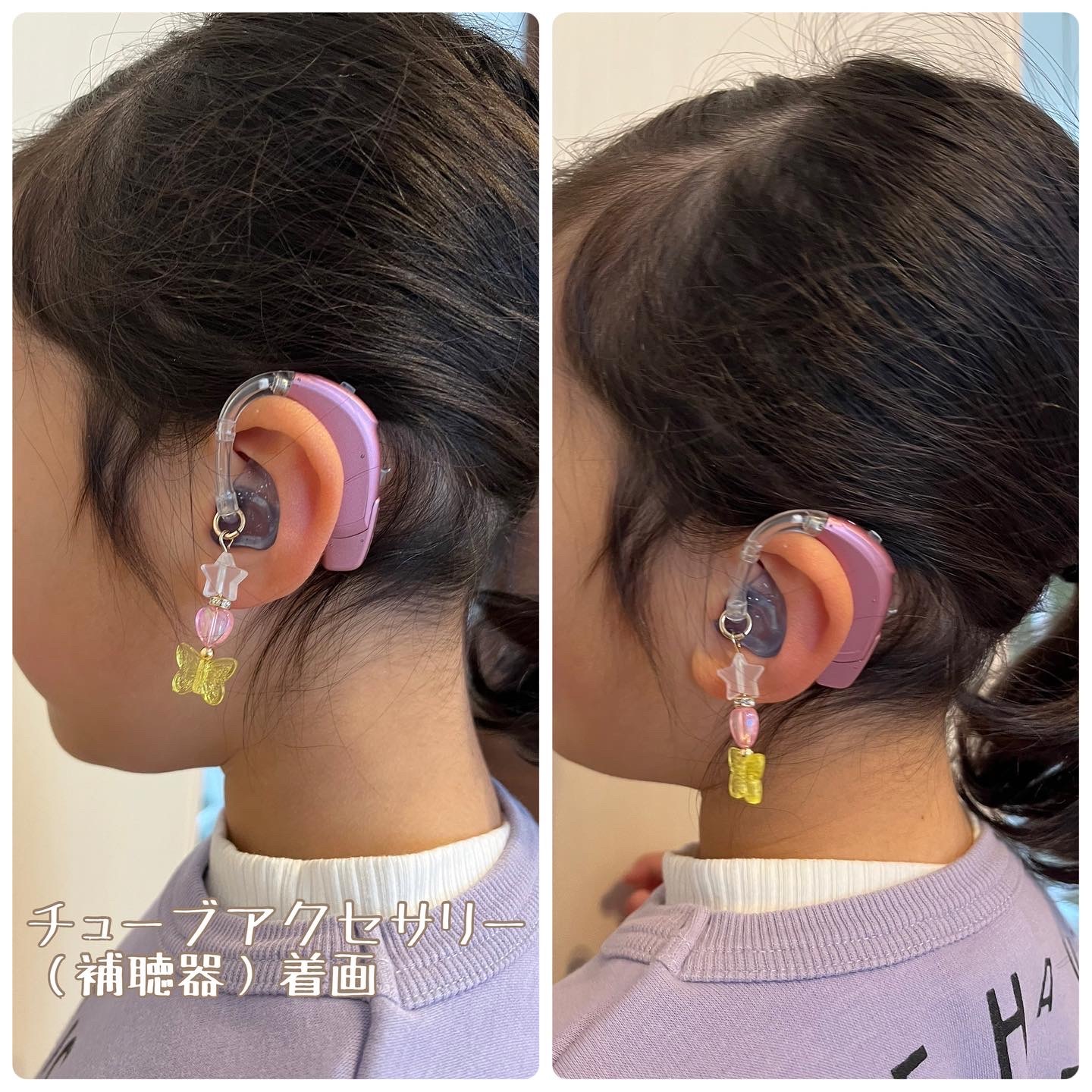 人工内耳・補聴器】チューブアクセサリー（桜チャーム・貴和