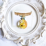 (ｱﾚﾙｷﾞｰ対応)③サンシャイン🌻ネックレス/ｻｰｼﾞｶﾙｽﾃﾝﾚｽ/レジン/大人可愛い/ひまわり