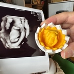 エコー写真を3Dプリンターでフィギュア化します！