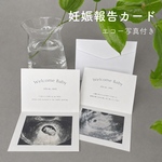 【 送料無料 】 折りたたみ式 妊娠報告 カード エコー写真 サプライズ ベビー マタニティ