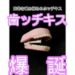 歯ッチキス(ホッチキス)