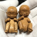 胎児　姉妹