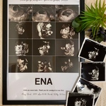 送料無料　A4  エコー写真フォトポスター　メモリアルポスター